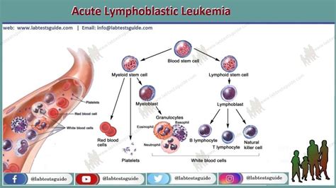 Tests for Acute Lymphocytic Leukemia (ALL) .